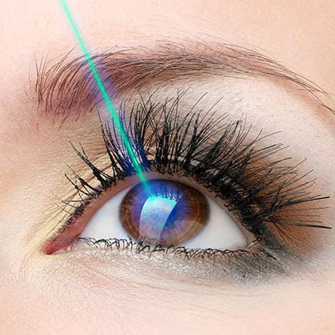 Lazer tedavisi “Göz çizdirme” nedir?